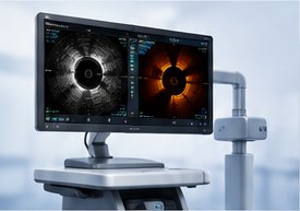 Intravascular imaging console